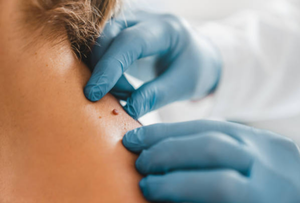 Petites chirurgies dermatologiques