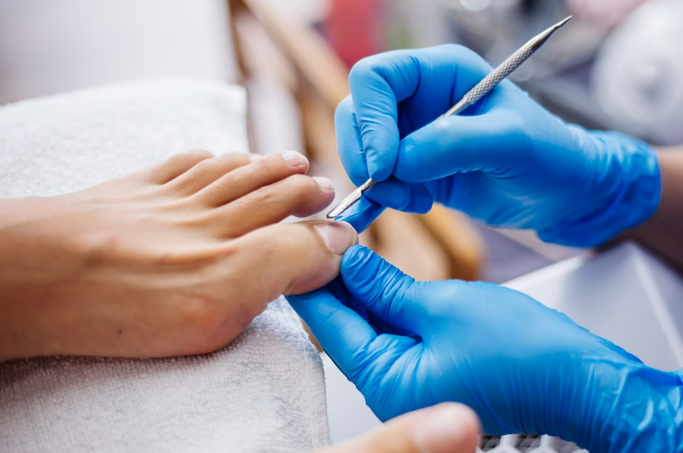 Chirurgie de l'ongle